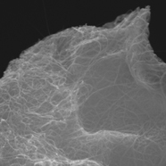 XBC grade CNT forms extensive secondary particles (i.e. ropes)